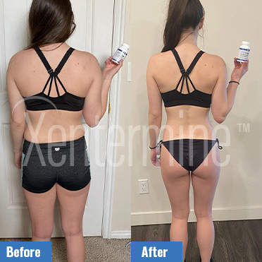 xentermine before and after